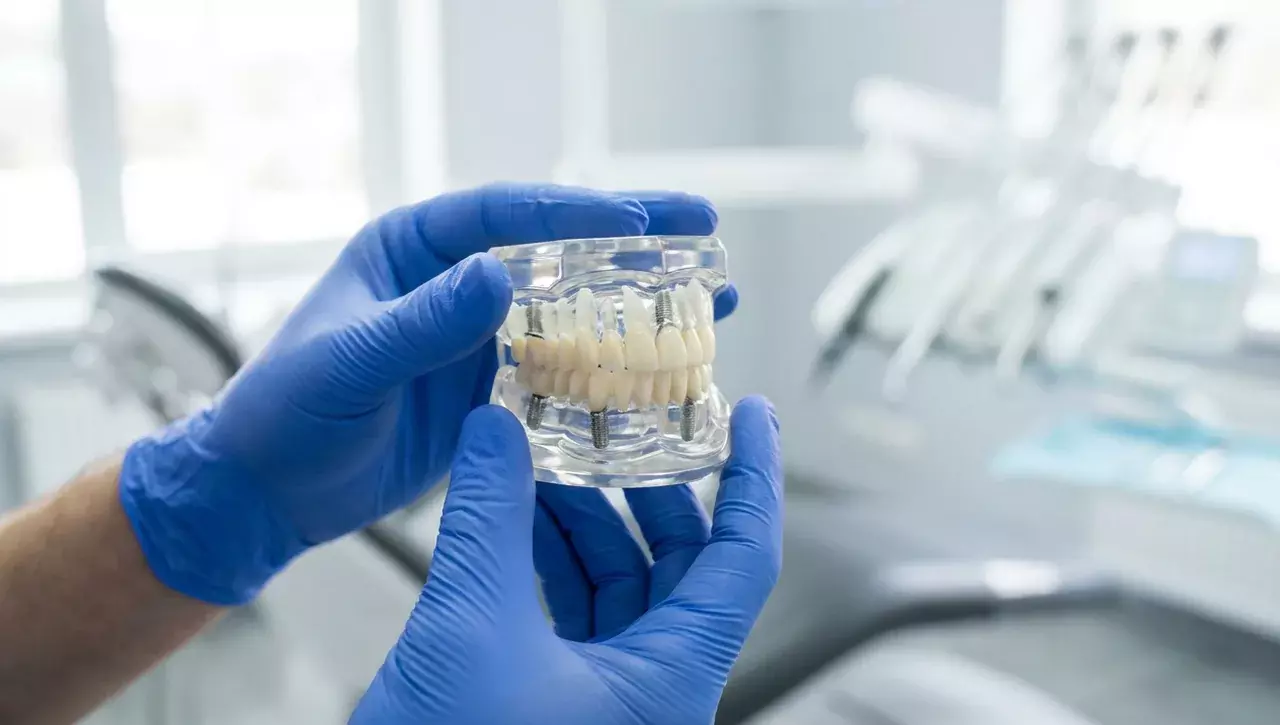 All-on-4 und All-on-6 Modell - festsitzende Zähne auf Implantaten, Zahnarzt München-Neuhausen